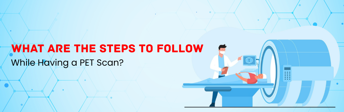 What Are the Steps to Follow While Having a PET Scan?